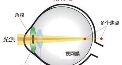 龙岩市哪里有眼镜验光师培训如何判断眼睛是否散光