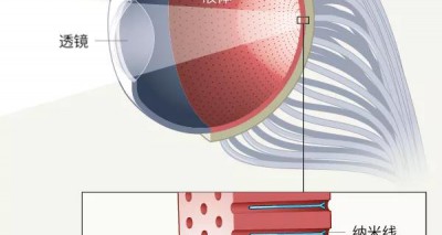 光敏纳米线、半球形视网膜：特别像人眼的仿生眼