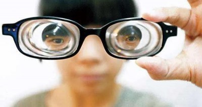 亚洲女性近视患者更容易发生视网膜脱落