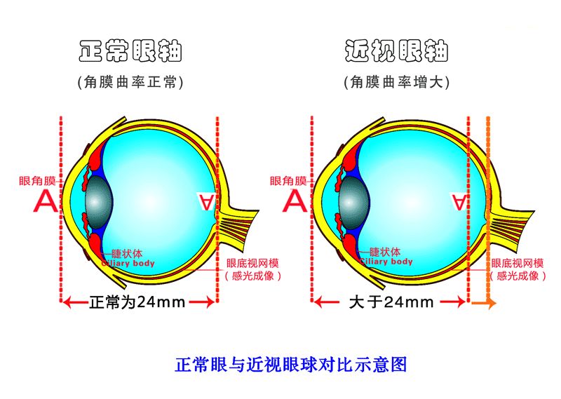 近视是怎样形成的？视普泰验光师培训学院带您走进了解