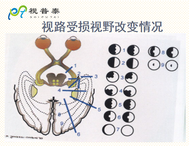 眼的解剖和生理