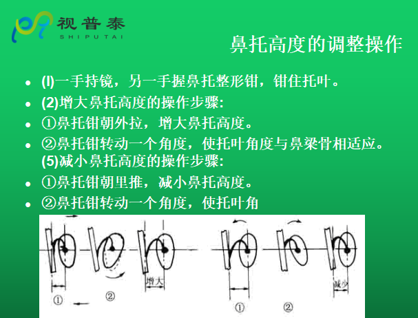 眼镜的整形校配