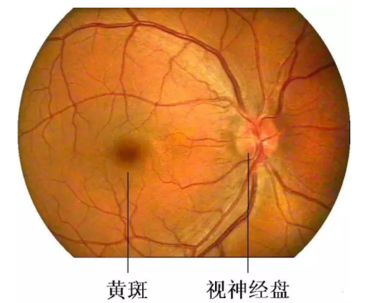 叶黄素是防止黄斑病变致老年失明的“视黄金”--验光师培训科普