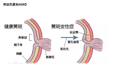 叶黄素是防止黄斑病变致老年失明的“视黄金”--验光师培训科普