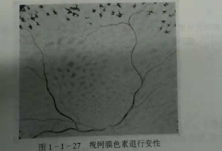 初级验光师培训知识点：影响视觉的原因分析