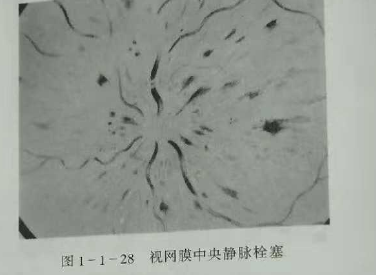 初级验光师培训知识点：影响视觉的原因分析