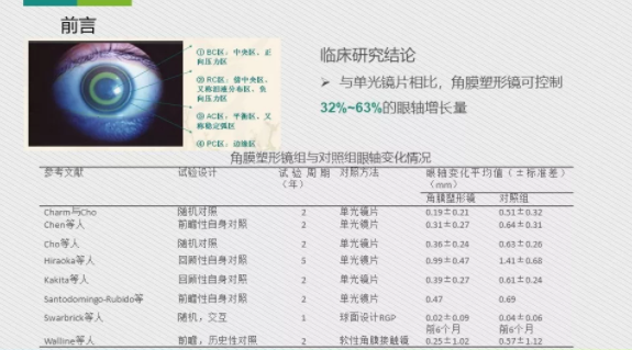 眼科医院眼视光医师分享角膜塑形镜的复诊流程