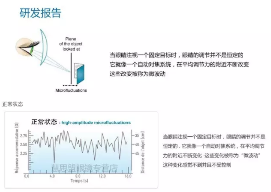 【验光师培训分享】镜片挑选的真相在哪？