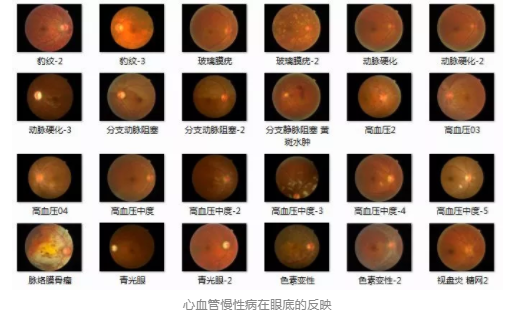 视光变革者宝岛眼镜CEO王智民：AI是慢性病、近视防控救星