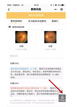 视光变革者宝岛眼镜CEO王智民：AI是慢性病、近视防控救星