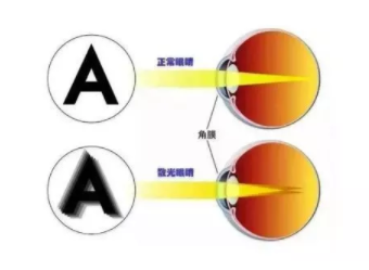 东莞验光师考证培训散光如何正确应对？