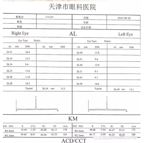 眼视光行业分享圆锥角膜验配RGP经验