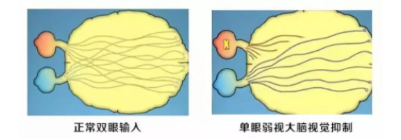 眼视光科普成人的弱斜视会影响正常生活吗？