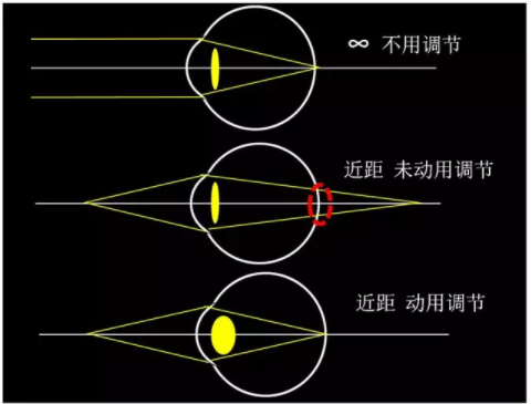 东莞验光师培训课程