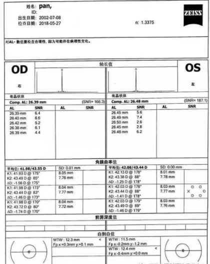 高度近视患者配戴角膜塑形镜的效果观察