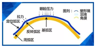 验光师讲述孩子戴了角膜塑形镜近视度数还会涨吗？