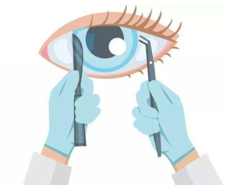 【眼视光前沿】如何提高患者角膜屈光手术后的视觉质量？