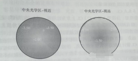 天津市眼科医院视光中心张姝贤主任：多焦点软性接触镜矫正老视的验配要点