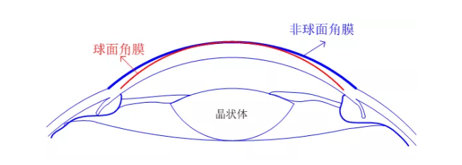 【眼视光前沿】一种具有非球面基弧设计的角膜塑形镜