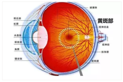 【验光师培训科普】一组图告诉你的眼底还健康吗？